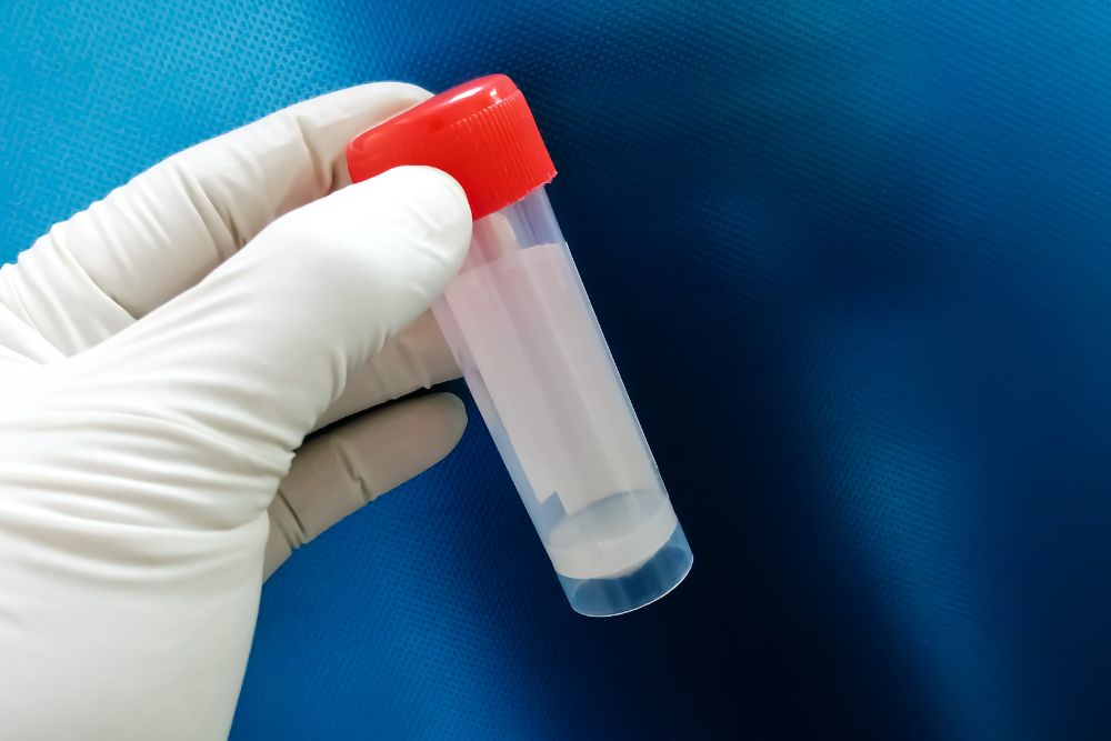 Overcoming No Sperm Count: Fertility Treatments for Men with Azoospermia
