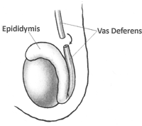 Vasectomy In In Portland Or